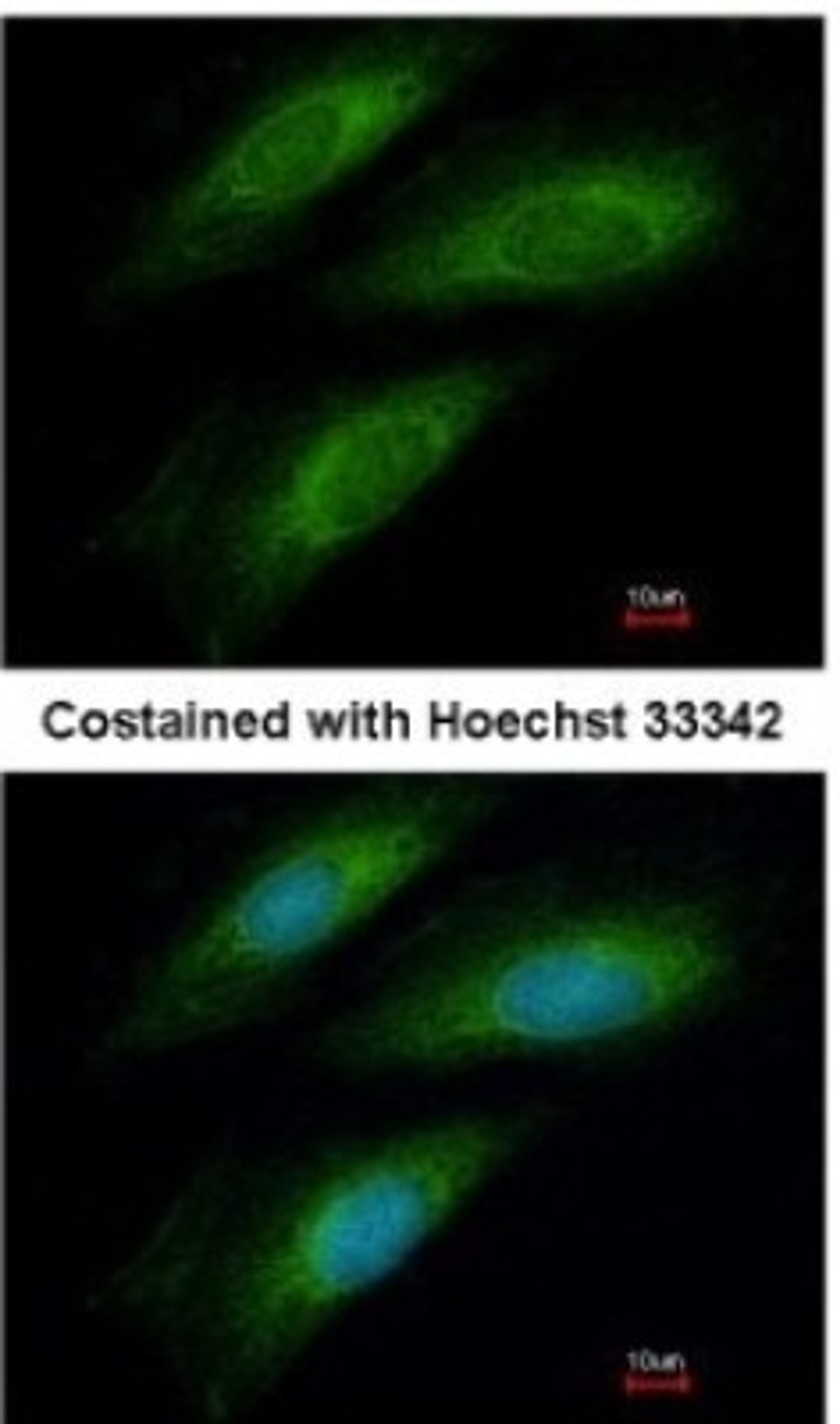 Immunocytochemistry/Immunofluorescence: ISCU Antibody [NBP2-14998] - Analysis of methanol-fixed HeLa, using antibody at 1:200 dilution.