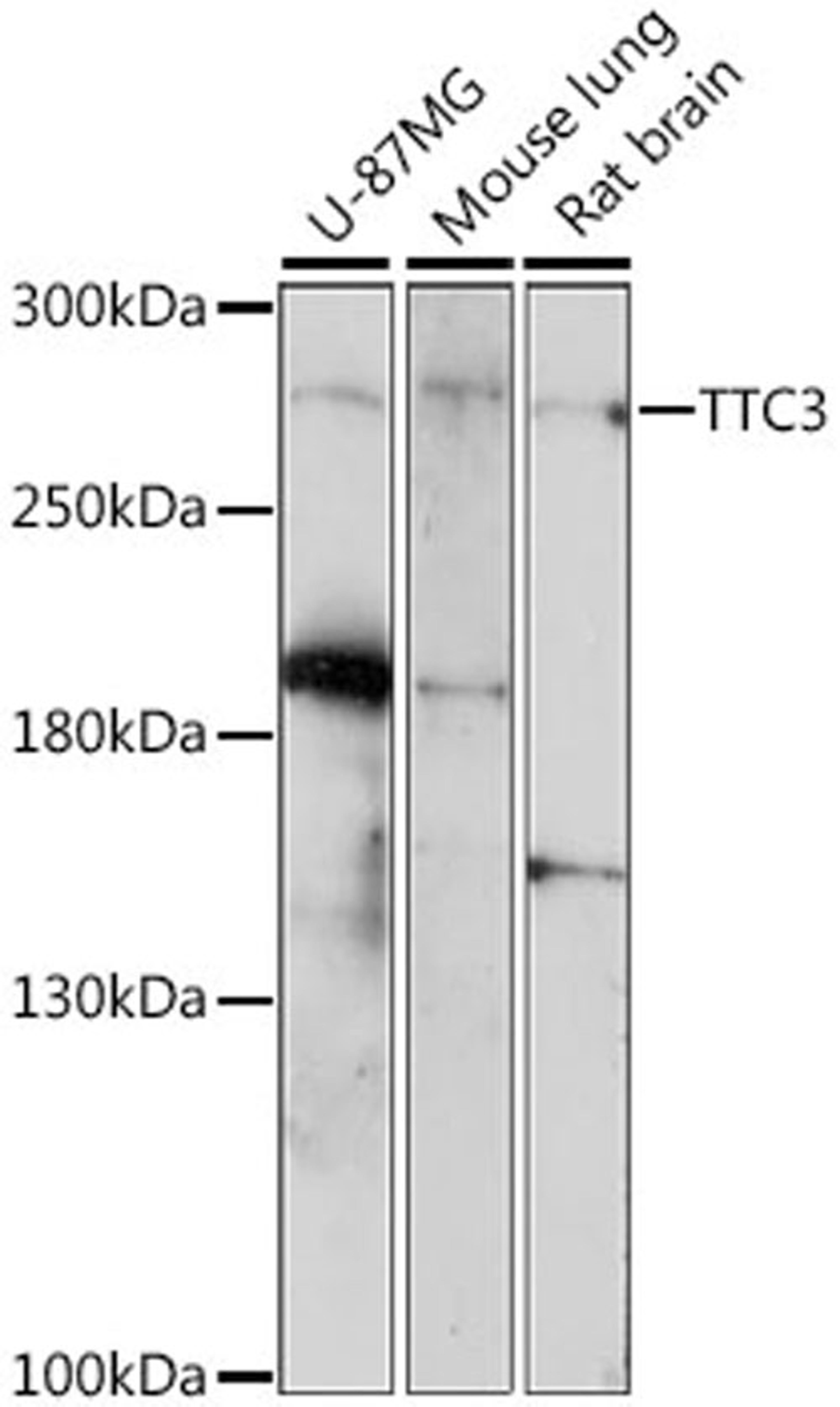 Western blot - TTC3 antibody (A15734)