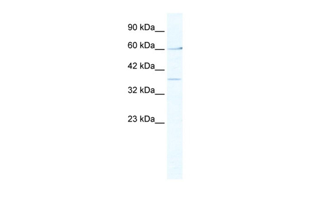 Antibody used in WB on Human Jurkat cells at 2.5 ug/ml.