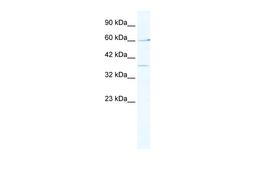 Antibody used in WB on Human Jurkat cells at 2.5 ug/ml.