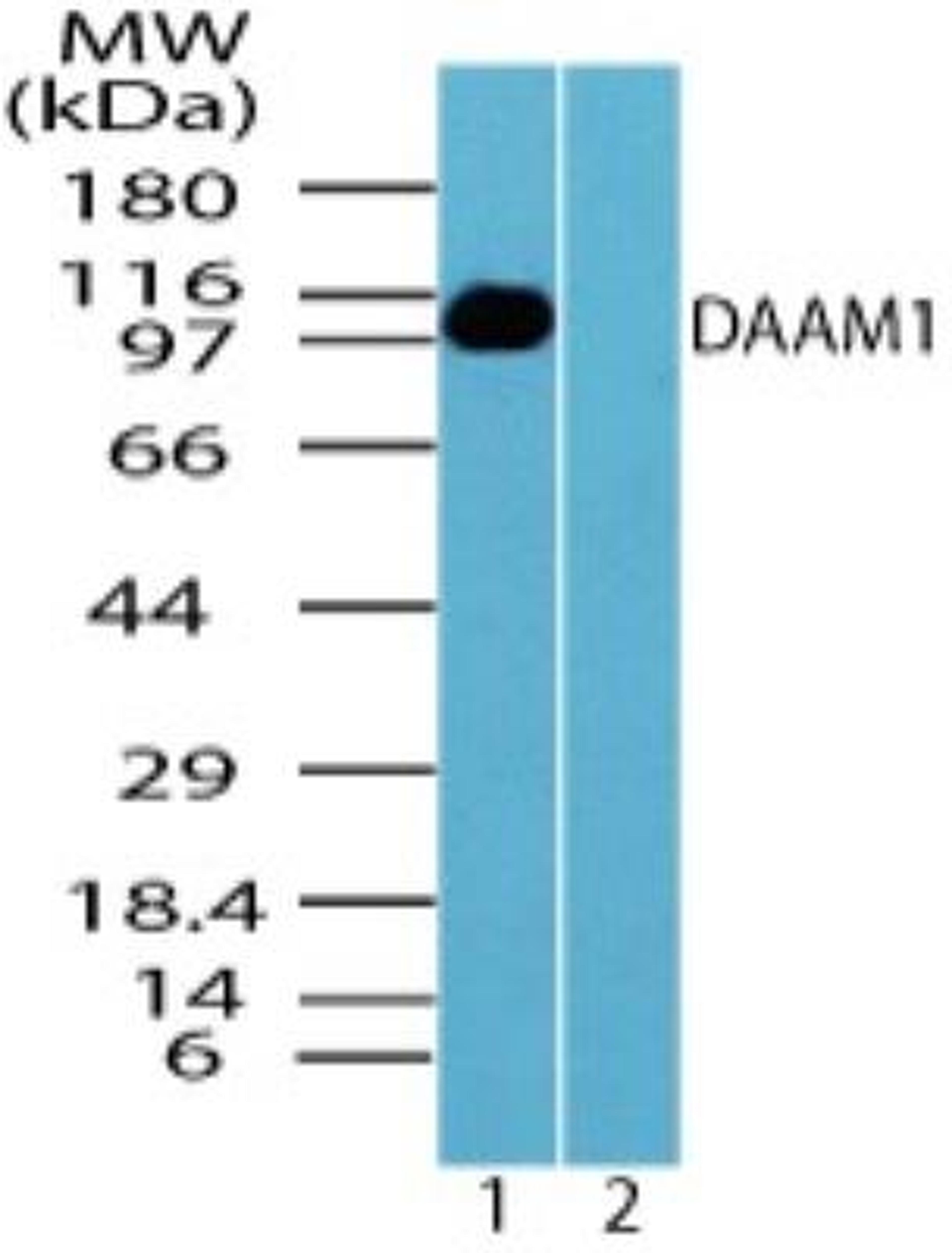 Western Blot: DAAM1 Antibody [NBP2-24623] - Analysis of DAAM1 in human skeletal muscle lysate in the 1) absence and 2) presence of immunizing peptide using NBP2-24623 5.0 ug/ml.