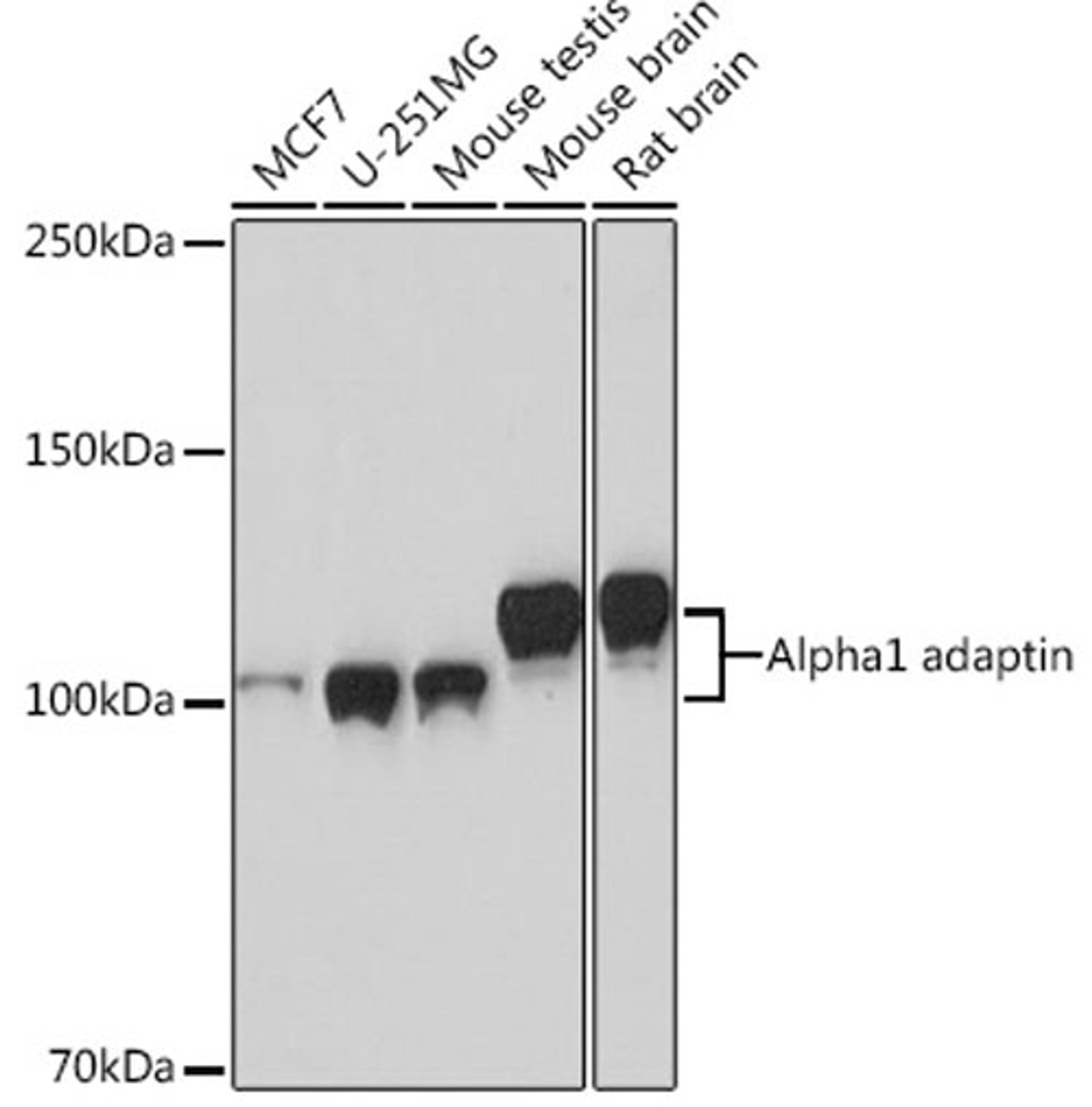 Western blot - Alpha1 adaptin Rabbit mAb (A4403)