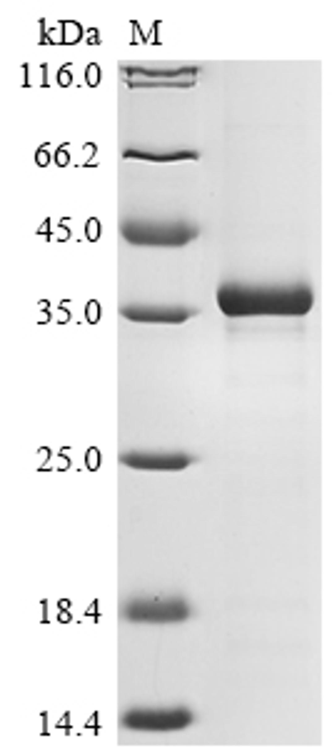 (Tris-Glycine gel) Discontinuous SDS-PAGE (reduced) with 5% enrichment gel and 15% separation gel.