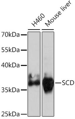 Western blot - SCD antibody (A16429)