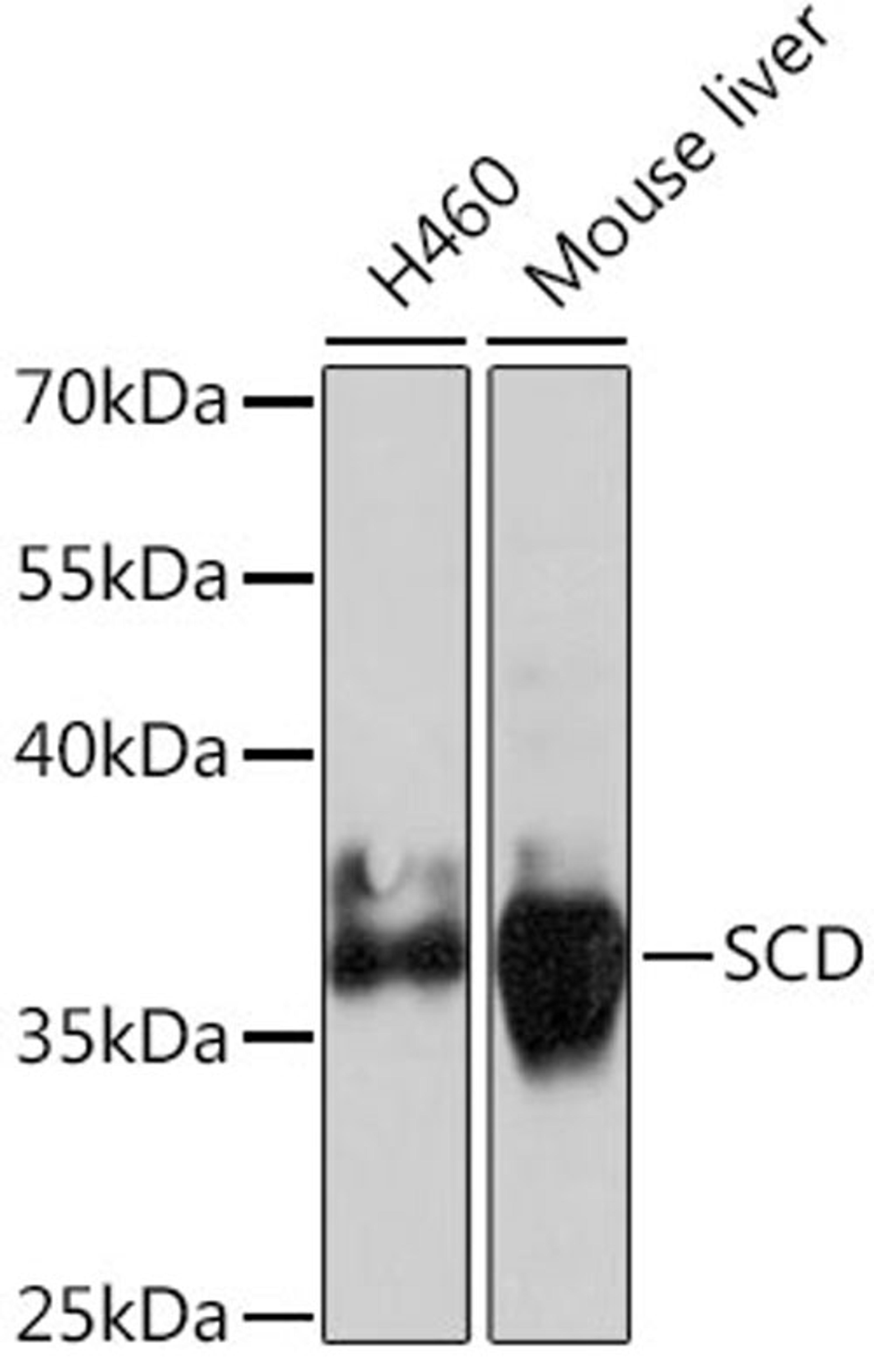 Western blot - SCD antibody (A16429)