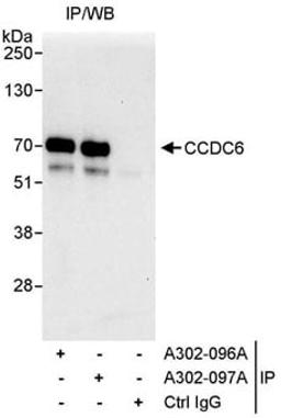 Detection of human CCDC6 by western blot of immunoprecipitates.