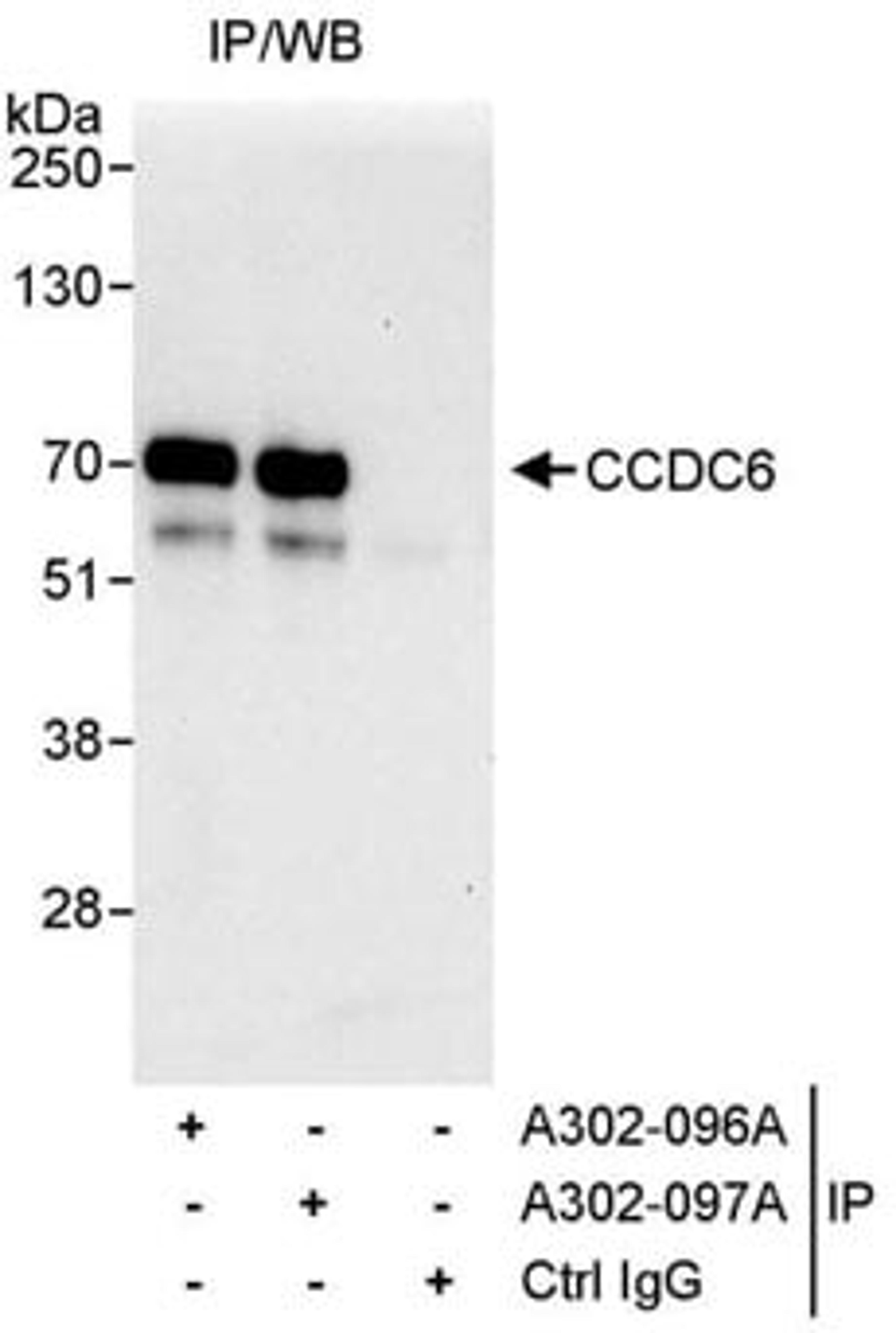 Detection of human CCDC6 by western blot of immunoprecipitates.