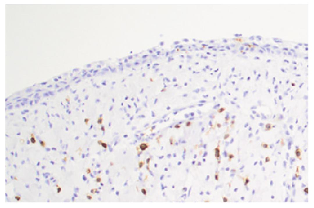 Paraffin embedded minipig vagina section post inoculation with C. trachomatis was stained with Mouse Anti-Porcine CD3?-UNLB followed by a secondary antibody and DAB.

Image from Erneholm K, Lorenzen E, Bøje S, Olsen AW, Andersen P, Cassidy JP, et al. Geni