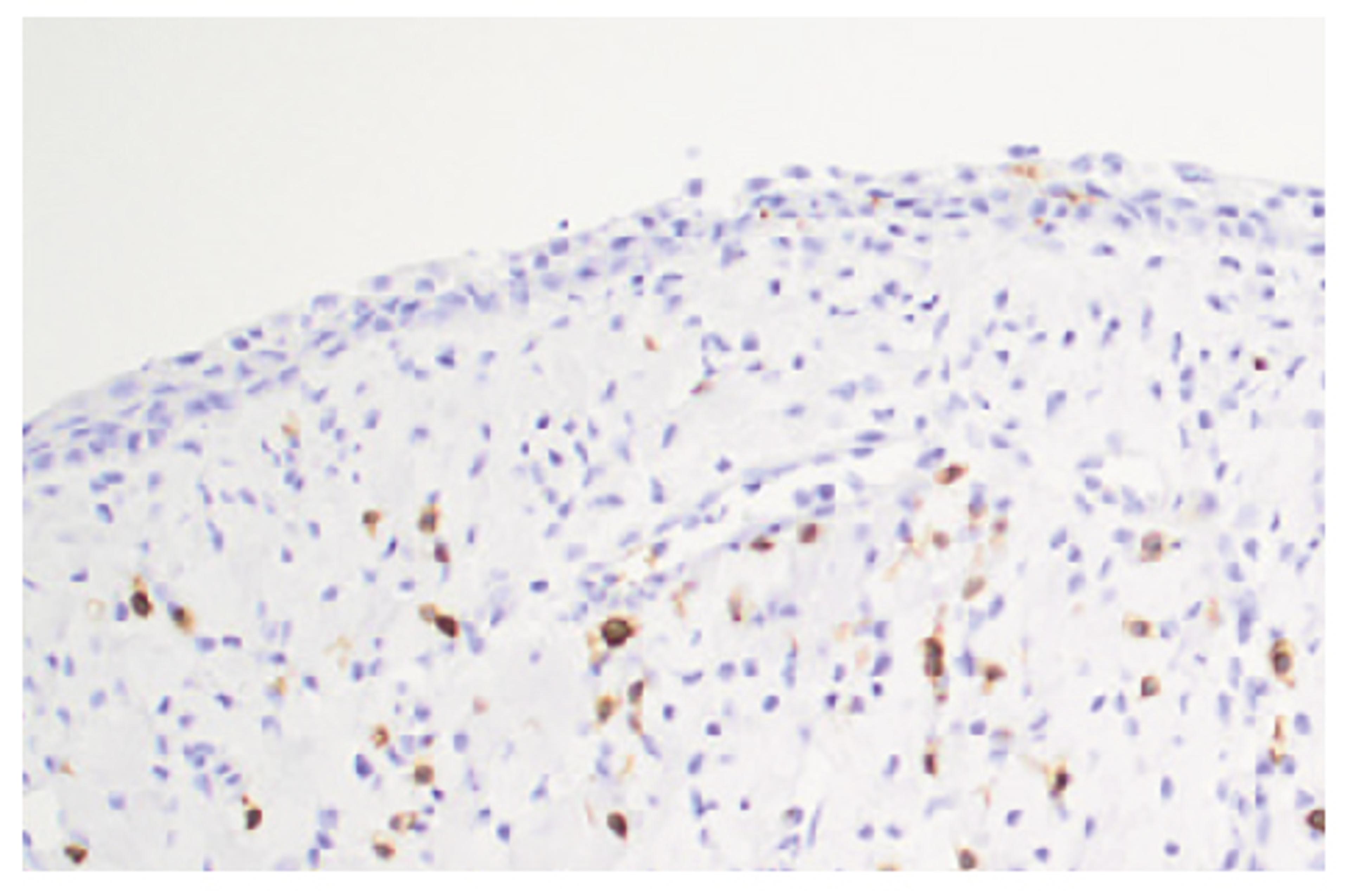 Paraffin embedded minipig vagina section post inoculation with C. trachomatis was stained with Mouse Anti-Porcine CD3?-UNLB followed by a secondary antibody and DAB.
Image from Erneholm K, Lorenzen E, Bøje S, Olsen AW, Andersen P, Cassidy JP, et al. Geni