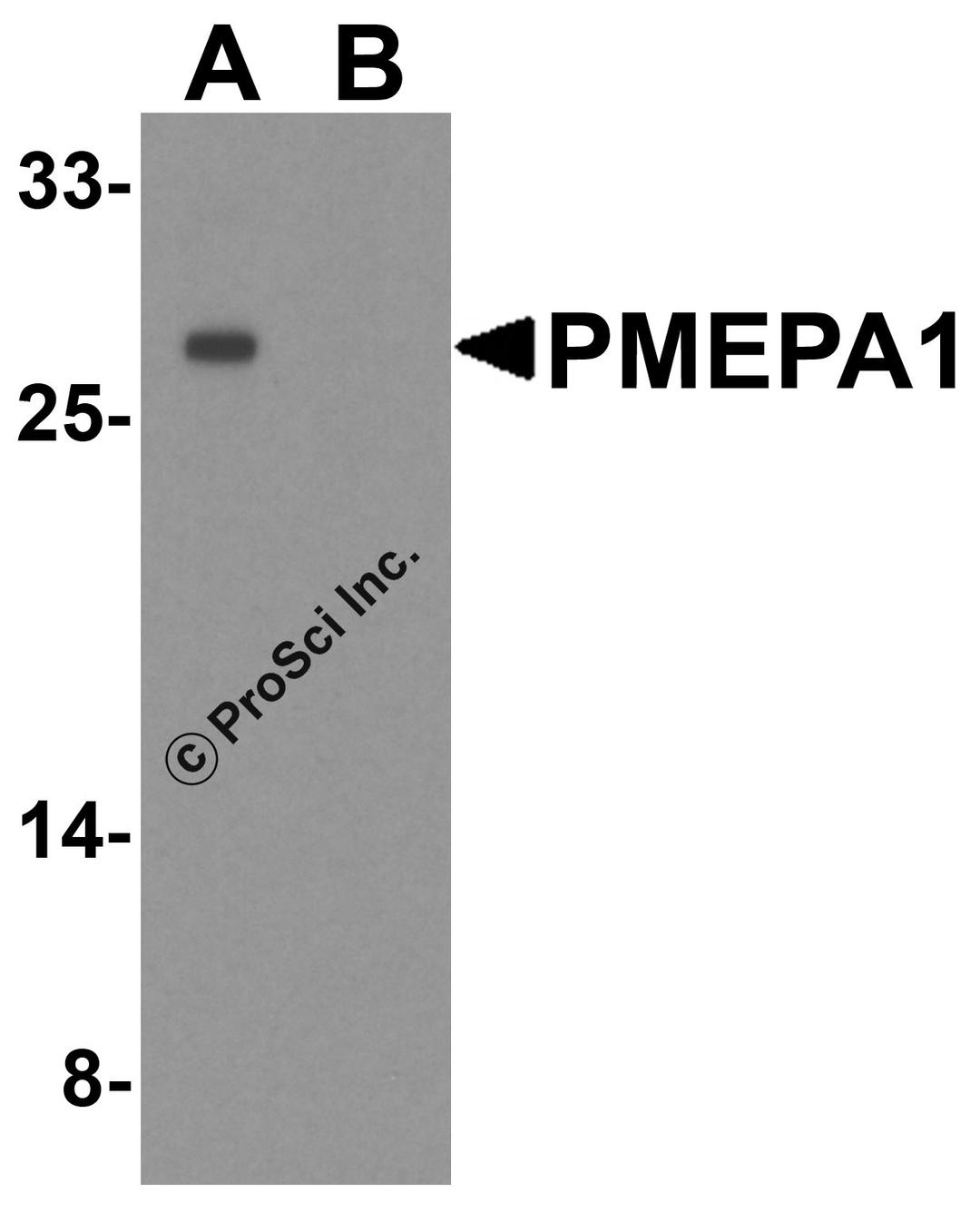 Western blot analysis of PMEPA1 inA549 cell lysate with PMEPA1 antibody at 1 μg/ml in (A) the absence and (B) the presence of blocking peptide.