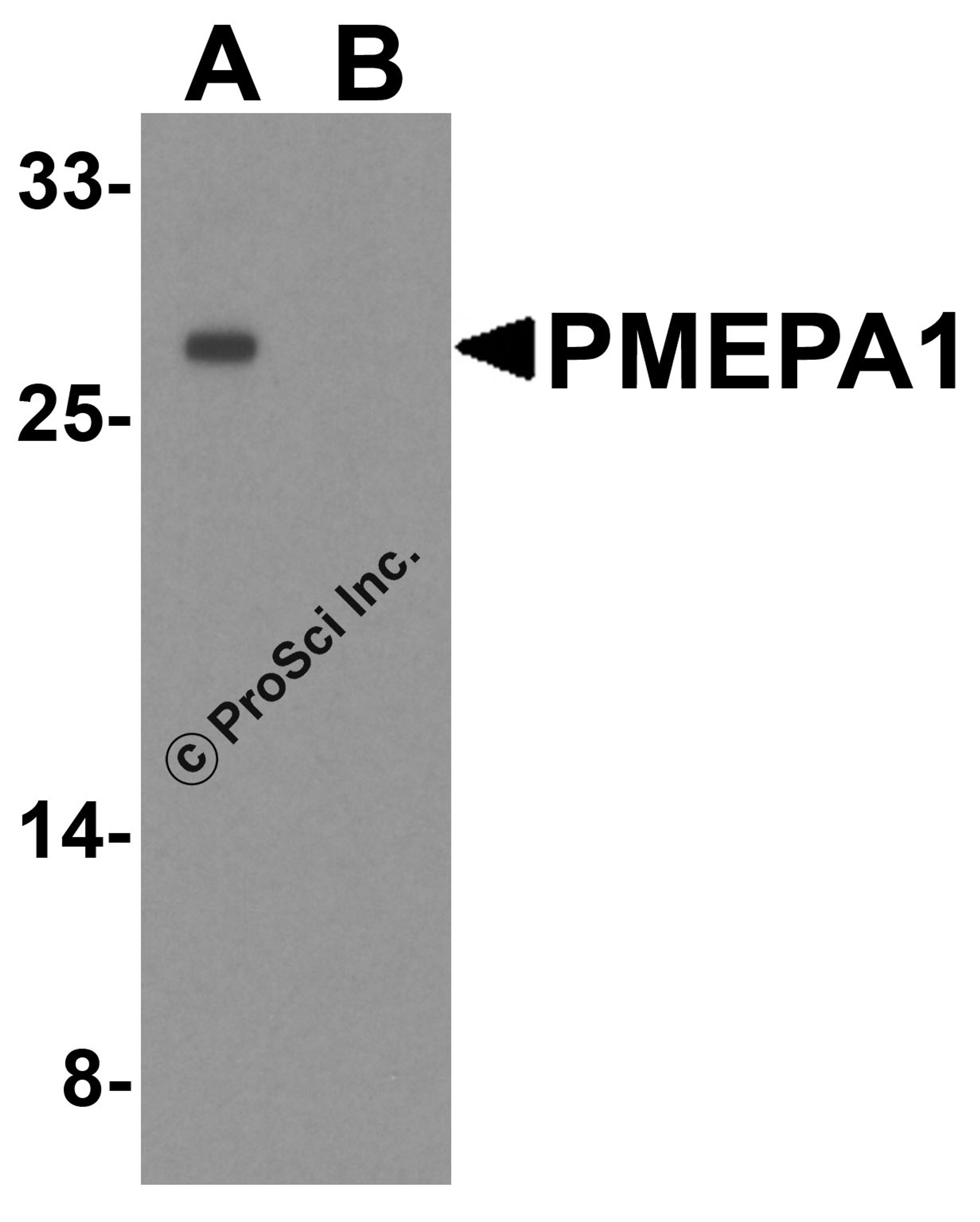 Western blot analysis of PMEPA1 inA549 cell lysate with PMEPA1 antibody at 1 μg/ml in (A) the absence and (B) the presence of blocking peptide.