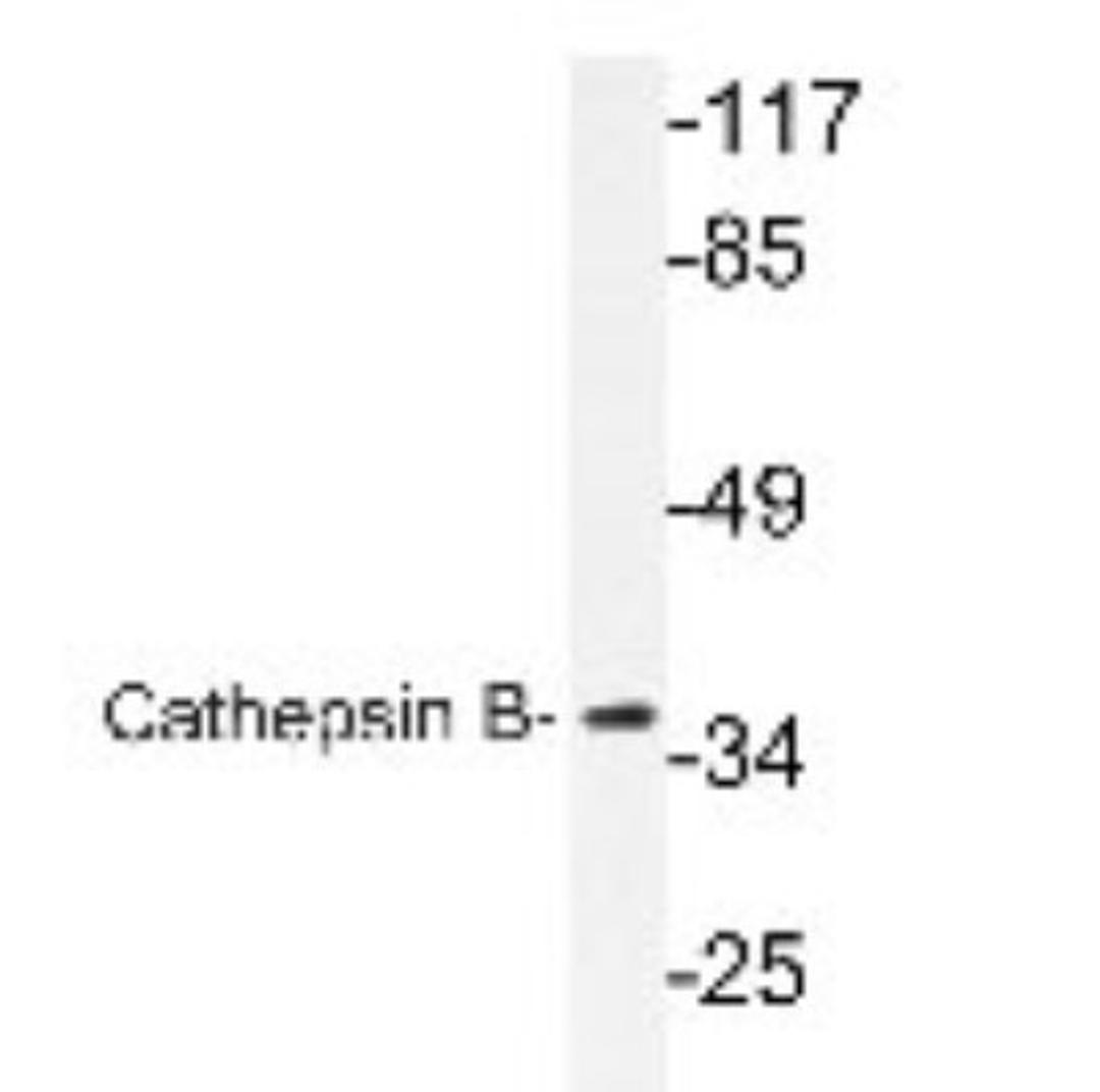 Western Blot: Cathepsin B Antibody [NBP1-19797] - extracts from COLO cells.