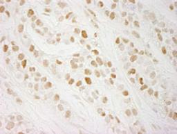 Detection of human CTF18 by immunohistochemistry.