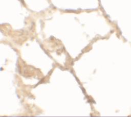 Immunohistochemistry of TFEB in human lung tissue with TFEB antibody at 2.5 &#956;g/mL.