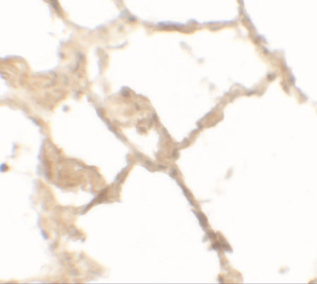 Immunohistochemistry of TFEB in human lung tissue with TFEB antibody at 2.5 μg/mL.