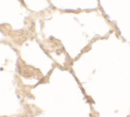 Immunohistochemistry of TFEB in human lung tissue with TFEB antibody at 2.5 μg/mL.
