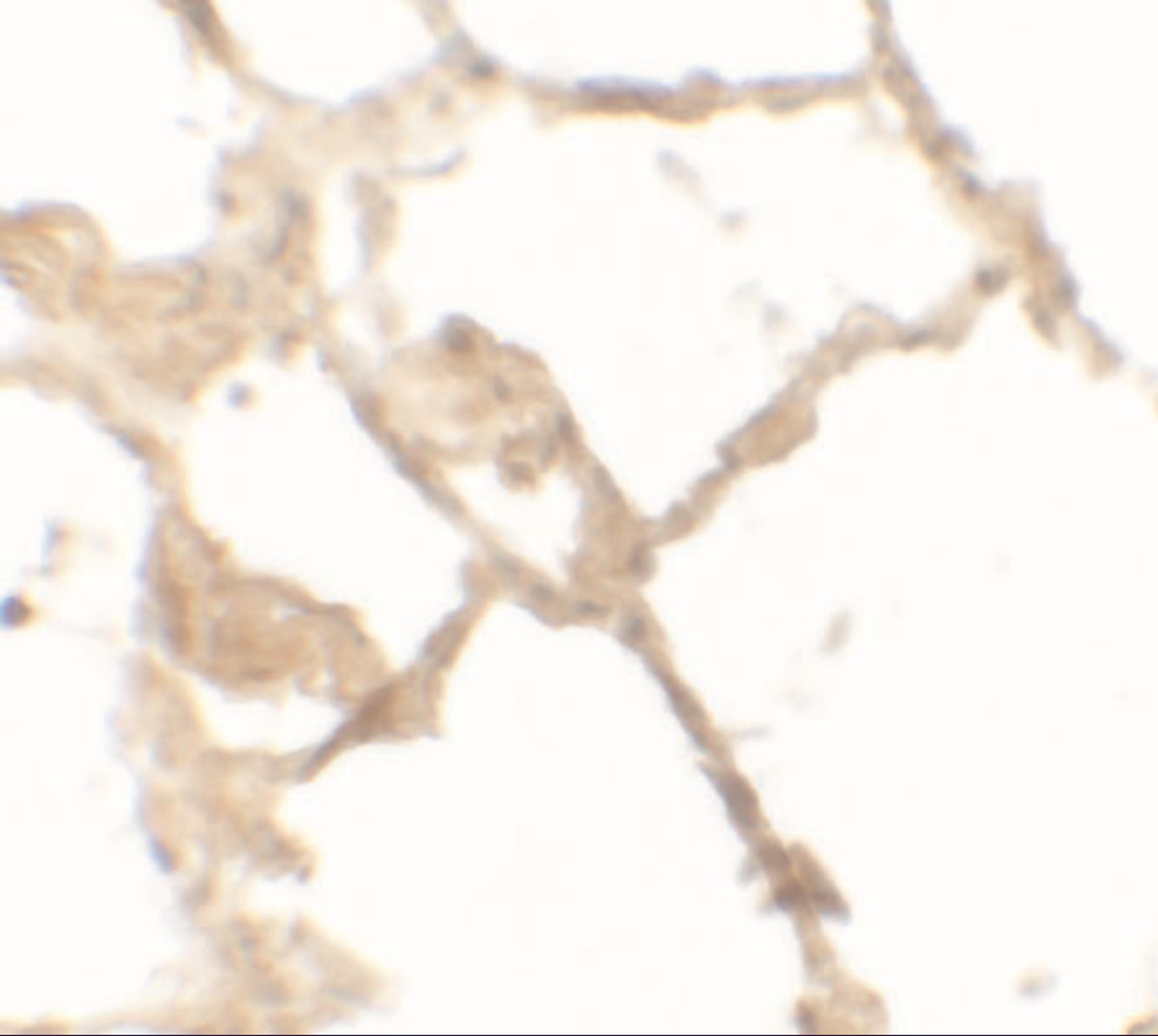 Immunohistochemistry of TFEB in human lung tissue with TFEB antibody at 2.5 μg/mL.