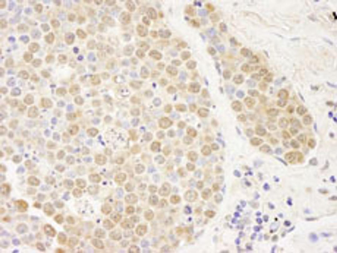 Detection of human PARP10 by immunohistochemistry.