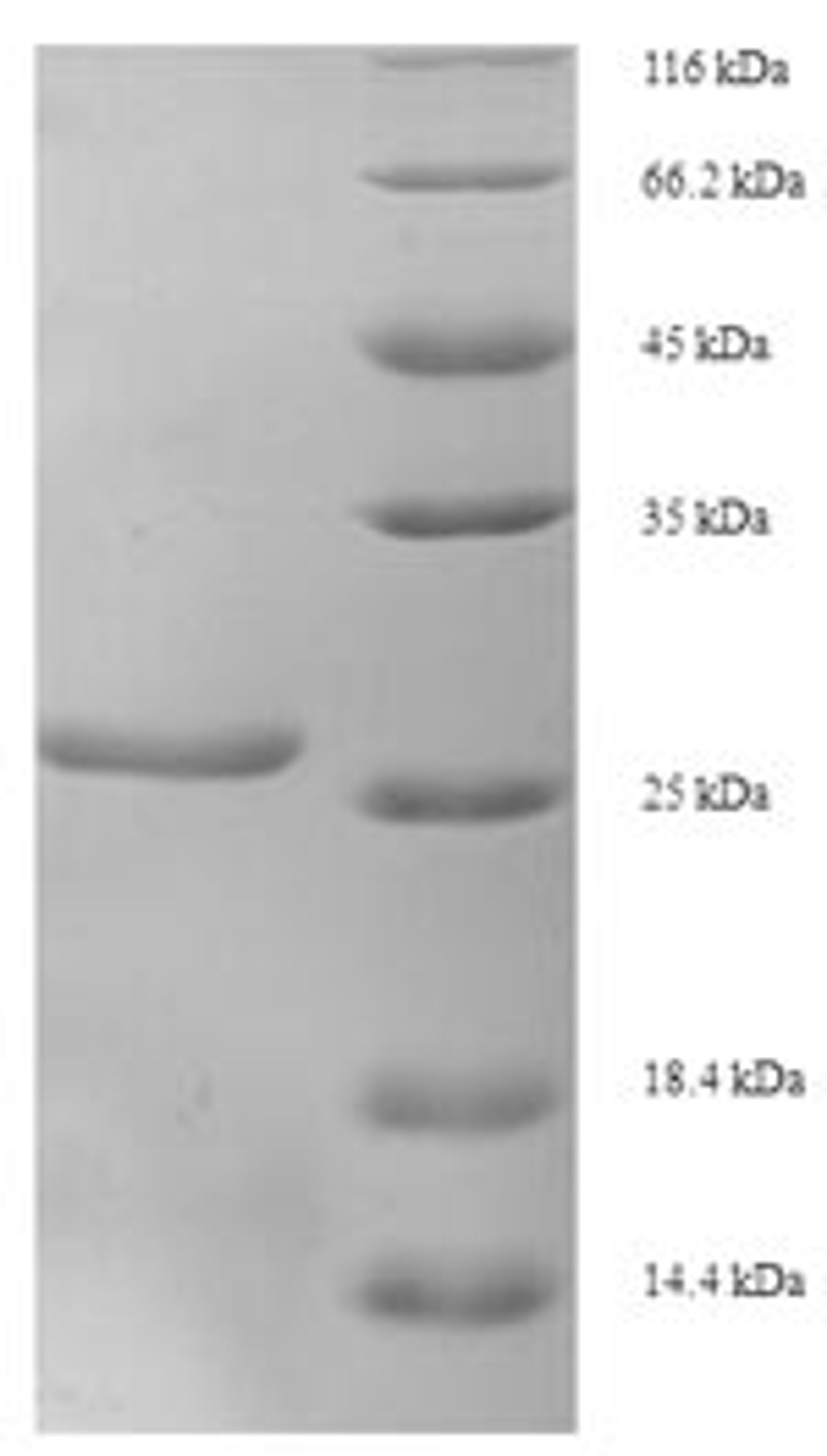 (Tris-Glycine gel) Discontinuous SDS-PAGE (reduced) with 5% enrichment gel and 15% separation gel.