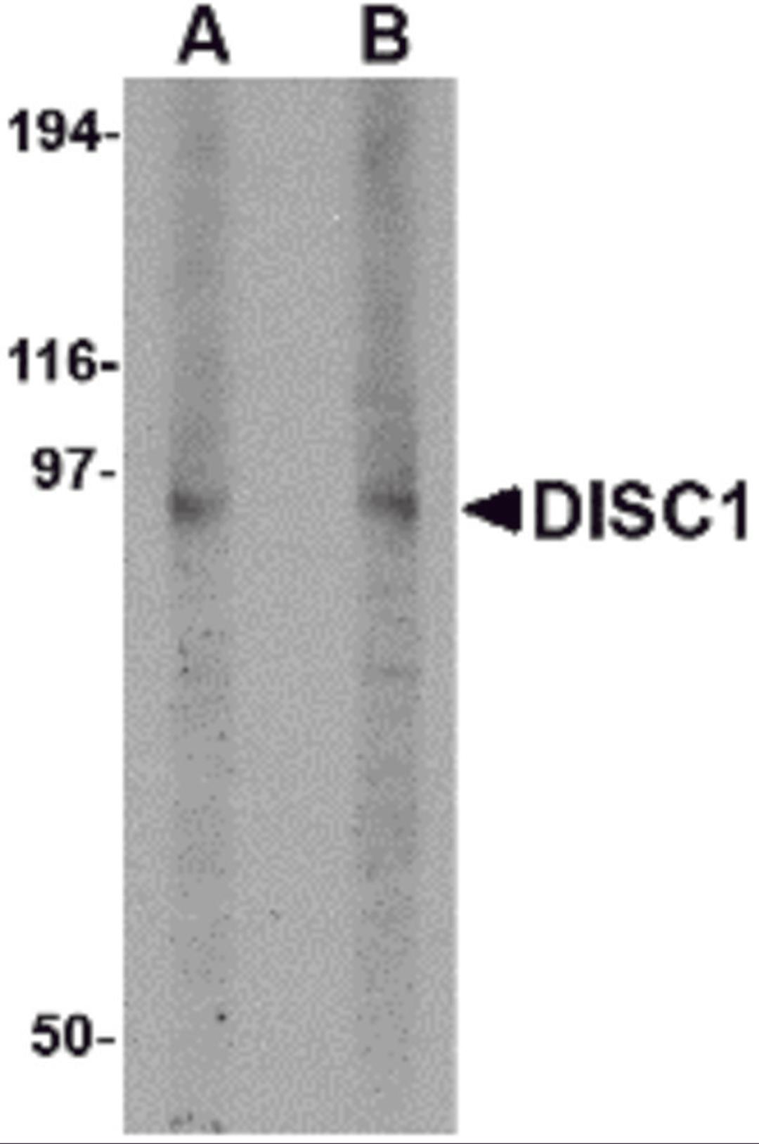 Western blot analysis of DISC1 in 3T3 cell lysate with DISC1 antibody at (A) 1 and (B) 2 μg/mL.