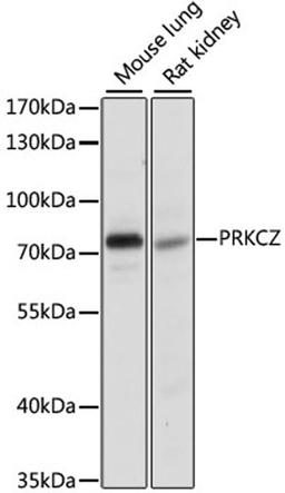 Western blot - PRKCZ antibody (A14178)