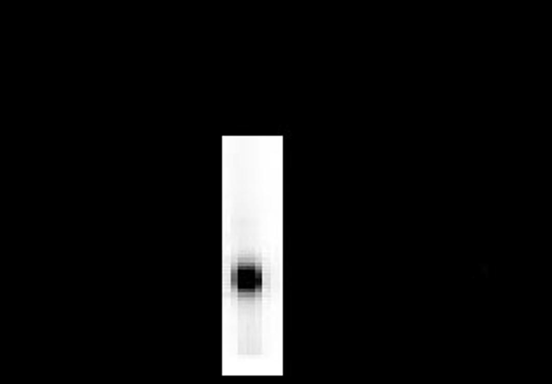 Dopamine Decarboxylase Antibody