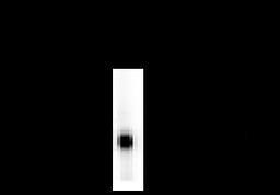 Dopamine Decarboxylase Antibody