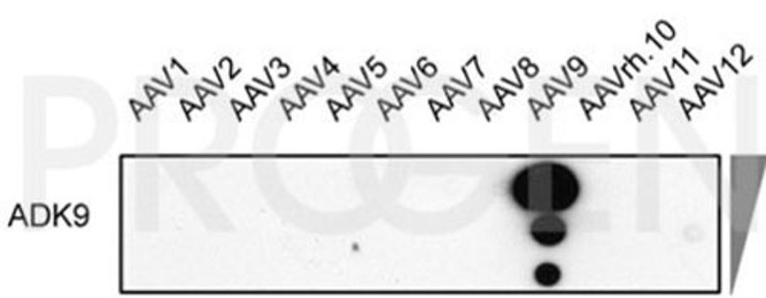 Dot blot with different AAV serotypes and mouse monoclonal anti-AAV9 antibody, clone ADK9 (Courtesy of Regina Heilbronn, Charité Universitätsmedizin Berlin, Mietzsch et al. Hum Gene Ther. 2014 Mar 1; 25(3):212-222)