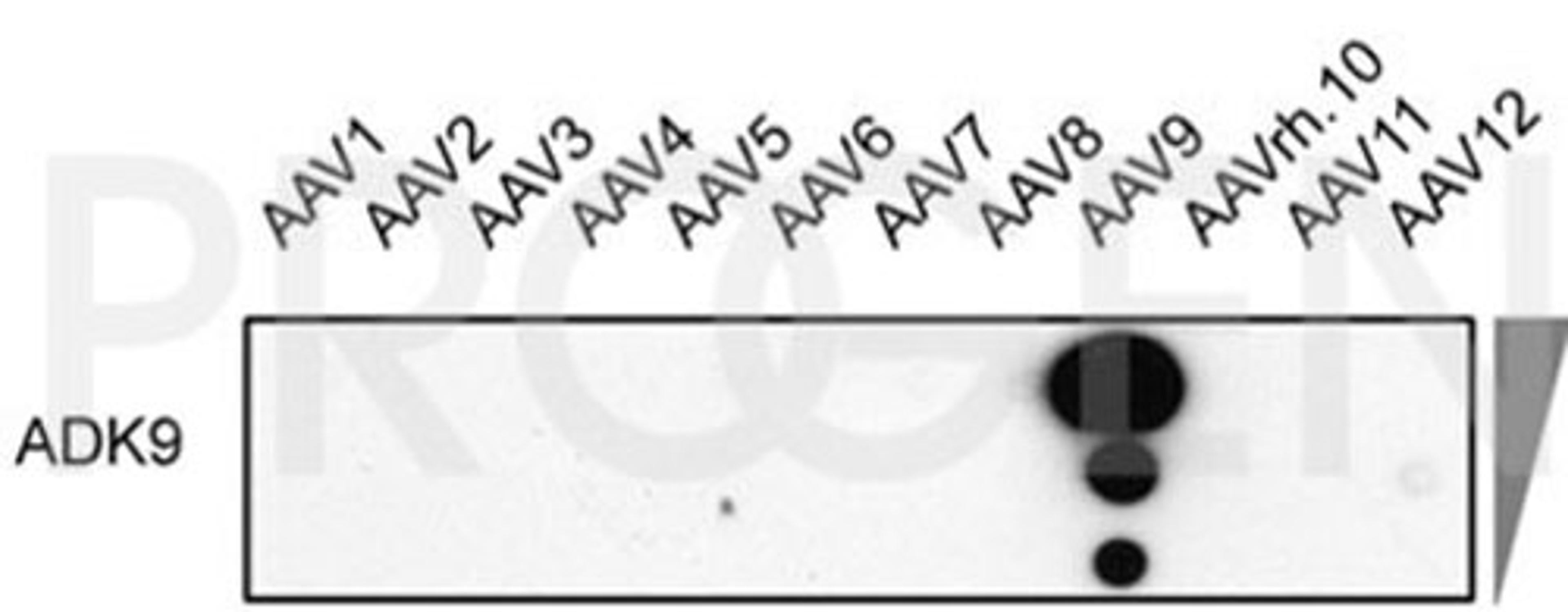 Dot blot with different AAV serotypes and mouse monoclonal anti-AAV9 antibody, clone ADK9 (Courtesy of Regina Heilbronn, Charité Universitätsmedizin Berlin, Mietzsch et al. Hum Gene Ther. 2014 Mar 1; 25(3):212-222)