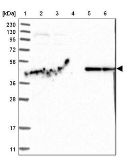 Western Blot: PISD Antibody [NBP1-84212] - Lane 1: Marker [kDa] 230, 130, 95, 72, 56, 36, 28, 17, 11<br/>Lane 2: Human cell line RT-4<br/>Lane 3: Human cell line U-251MG sp<br/>Lane 4: Human plasma (IgG/HSA depleted)<br/>Lane 5: Human liver tissue<br/>Lane 6: Human tonsil tissue