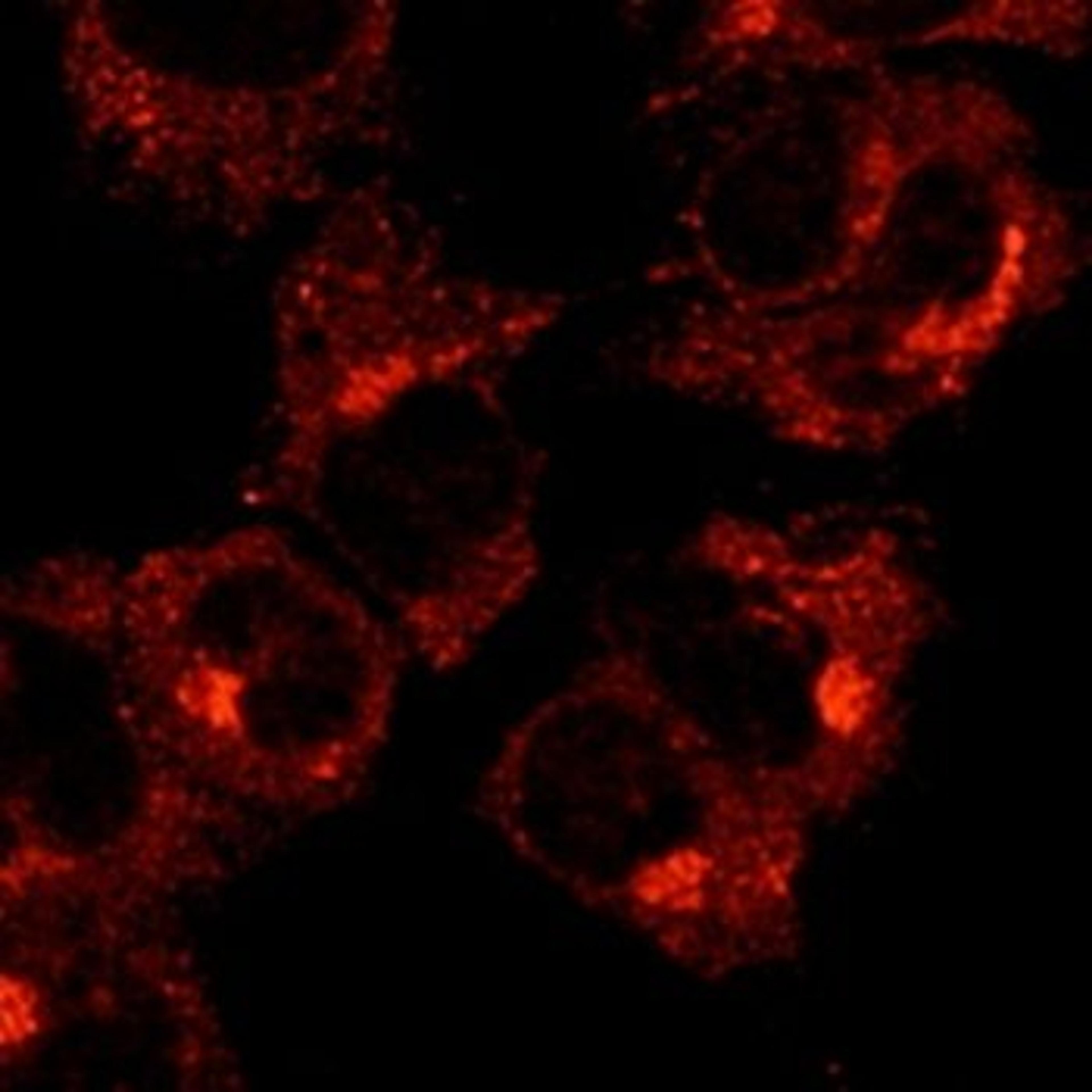 Confocal immunofluoroscence analysis of COS-7 cells using Rab1 antibody.