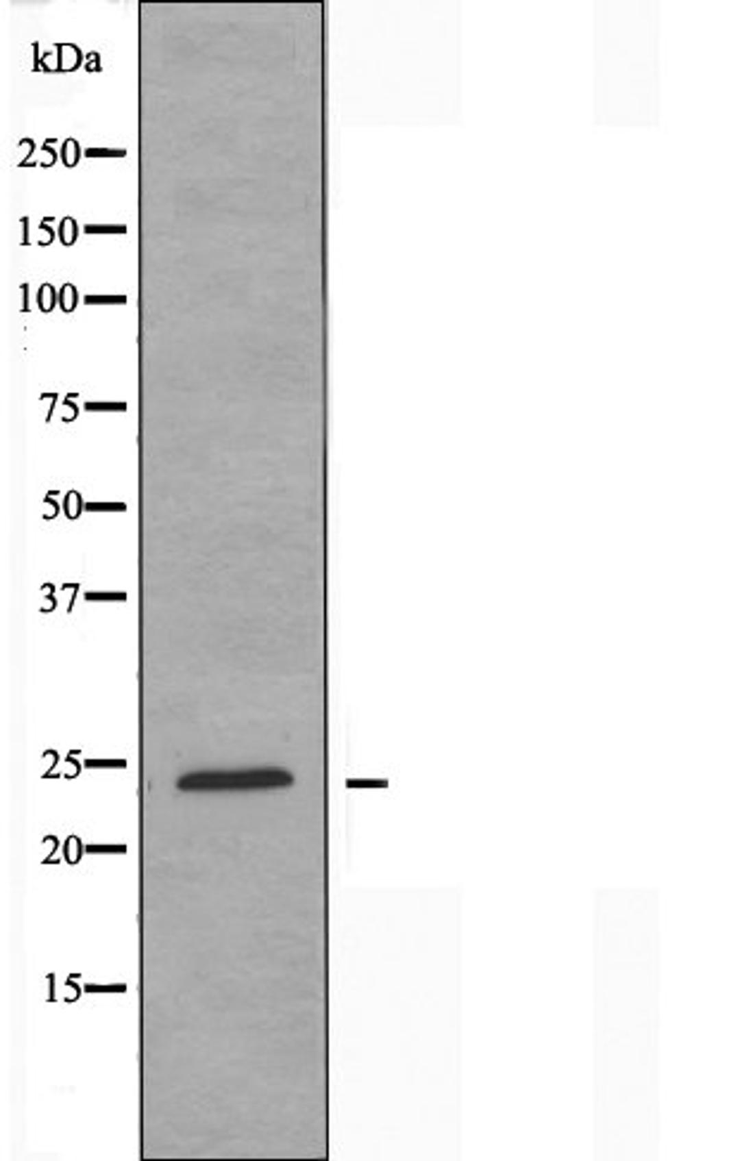 Western blot analysis of K562 cells using RL10 antibody