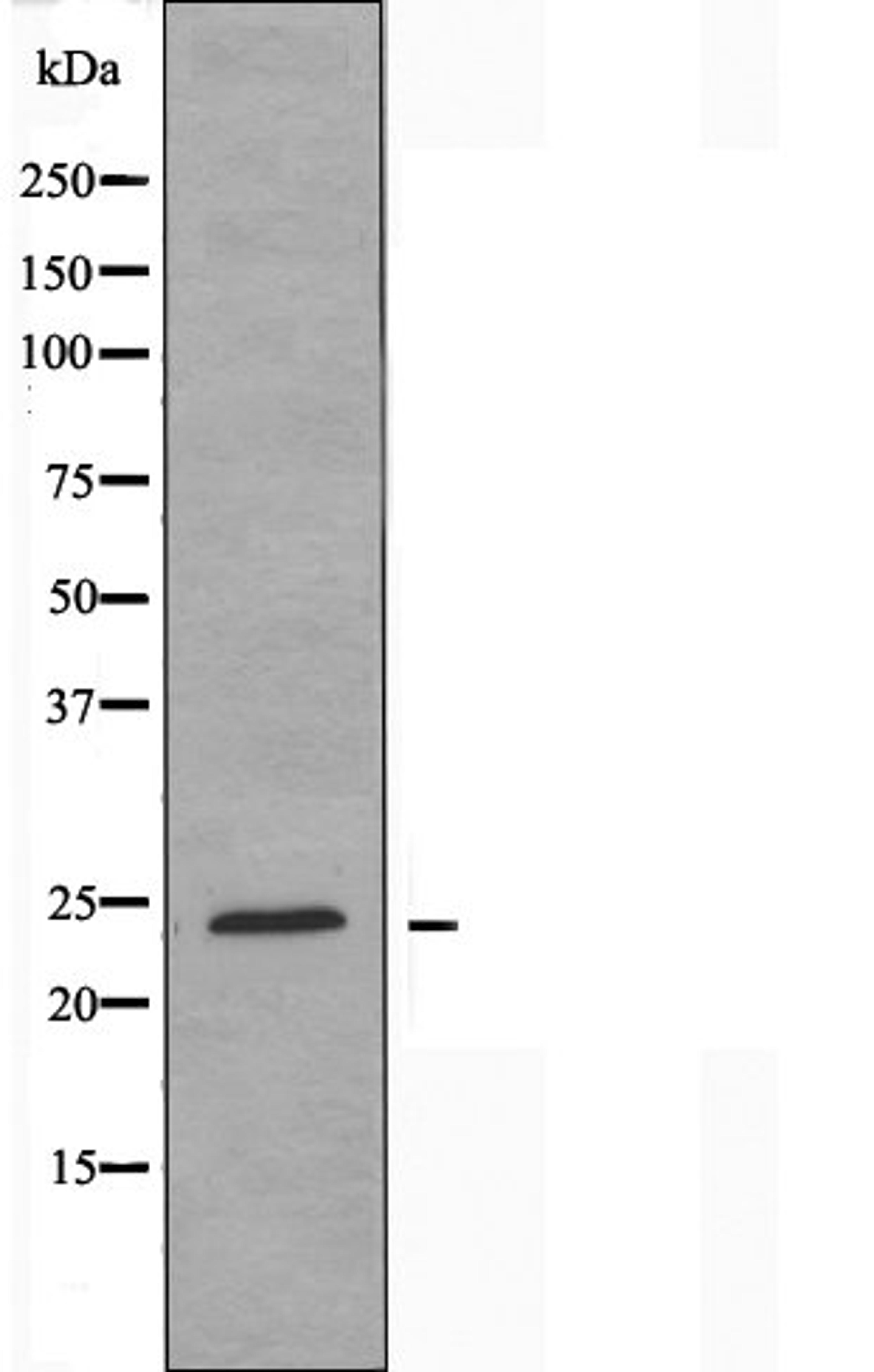 Western blot analysis of K562 cells using RL10 antibody