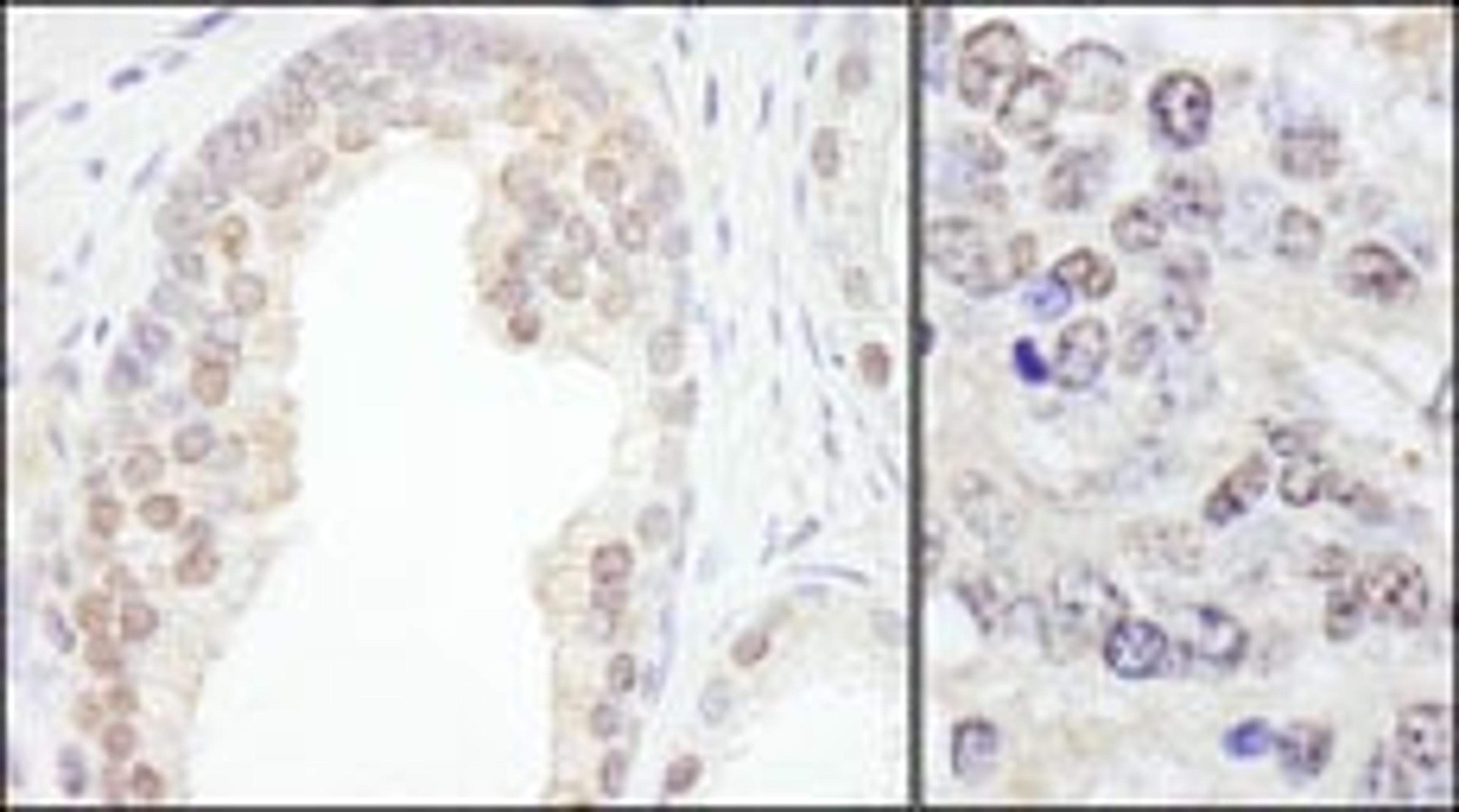 Detection of human and mouse TRIM33/TIF1gamma by immunohistochemistry.