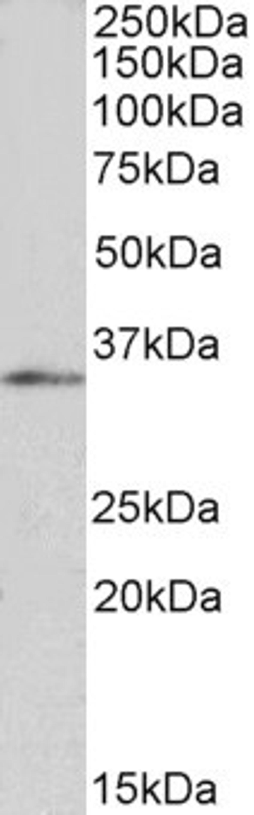 45-602 (1ug/ml) staining of HepG2 nuclear lysate (35ug protein in RIPA buffer). Primary incubation was 1 hour. Detected by chemiluminescence