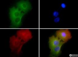 Immunocytochemistry/Immunofluorescence: ASC/TMS1 Antibody [NBP1-78977] - ASC/TMS1 antibody was tested in MCF-7 cells with FITC (green). Nuclei and alpha-tubulin were counterstained with DAPI (blue) and Dylight 550 (red).