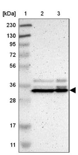 Western Blot: SFXN3 Antibody [NBP1-87047] - Lane 1: Marker [kDa] 230, 130, 95, 72, 56, 36, 28, 17, 11<br/>Lane 2: Human cell line RT-4<br/>Lane 3: Human cell line U-251MG sp