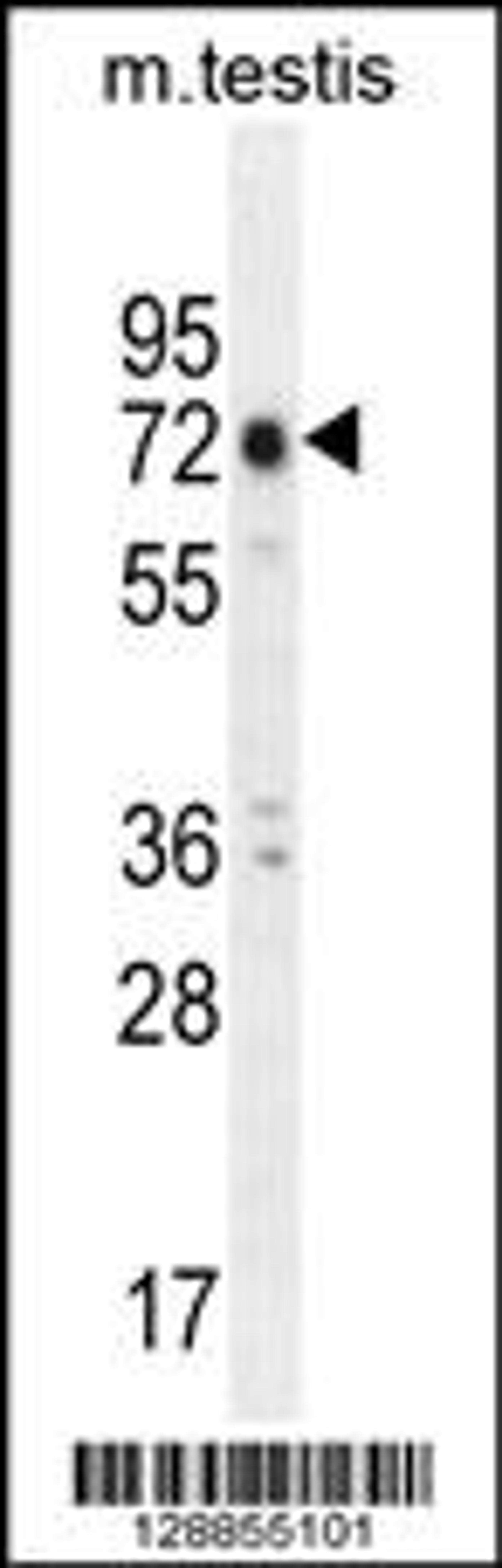 Western blot analysis in mouse testis tissue lysates (35ug/lane).