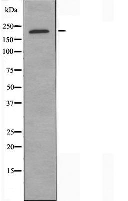 Western blot analysis of K562 cells using Collagen XI Alpha1 antibody