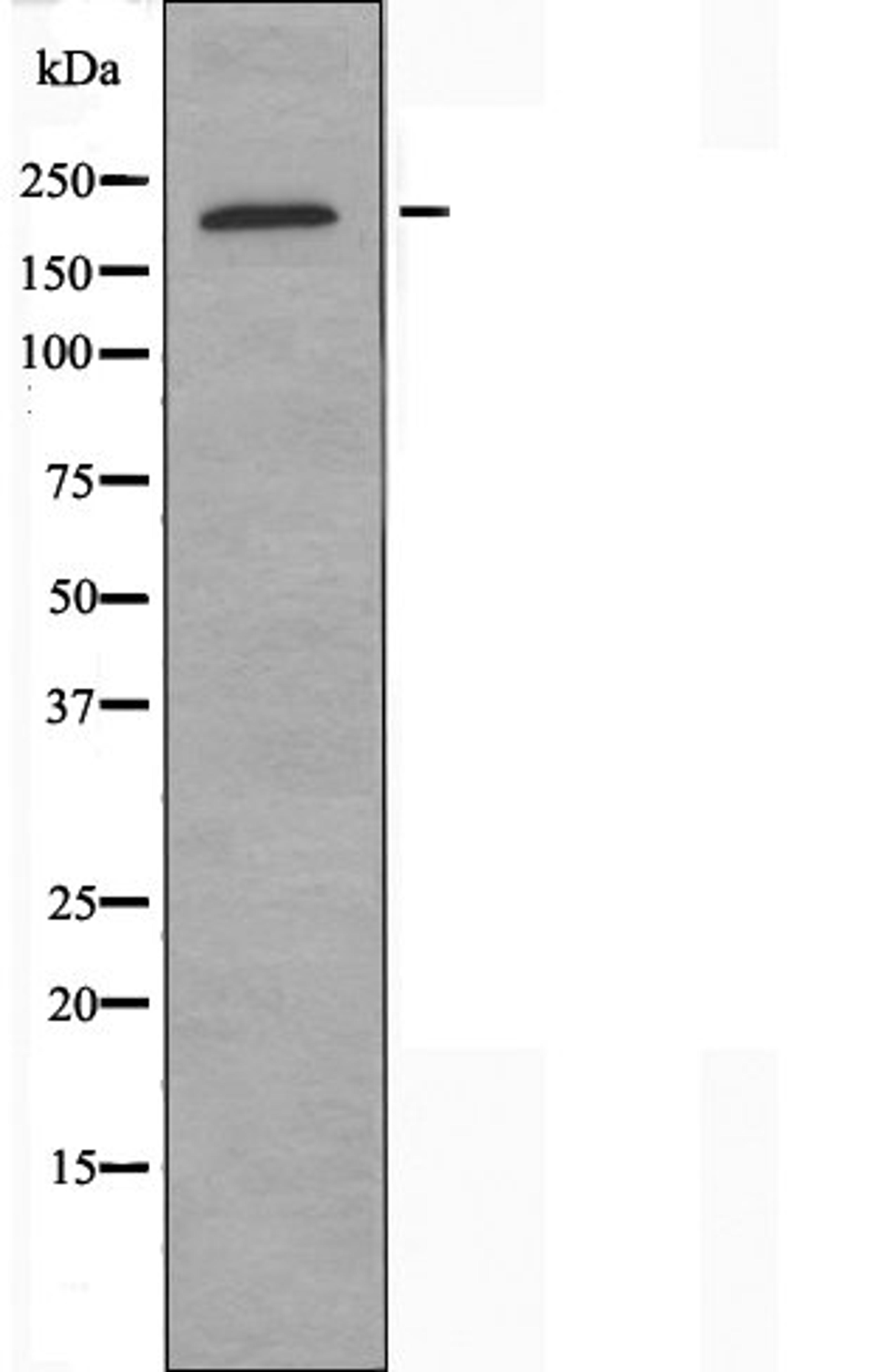 Western blot analysis of K562 cells using Collagen XI Alpha1 antibody