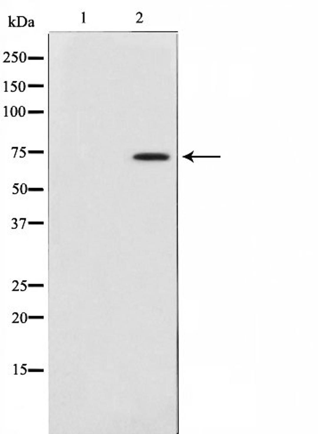 Western blot analysis of 3T3 cell lysate using Collagen XIIIalpha 1 antibody