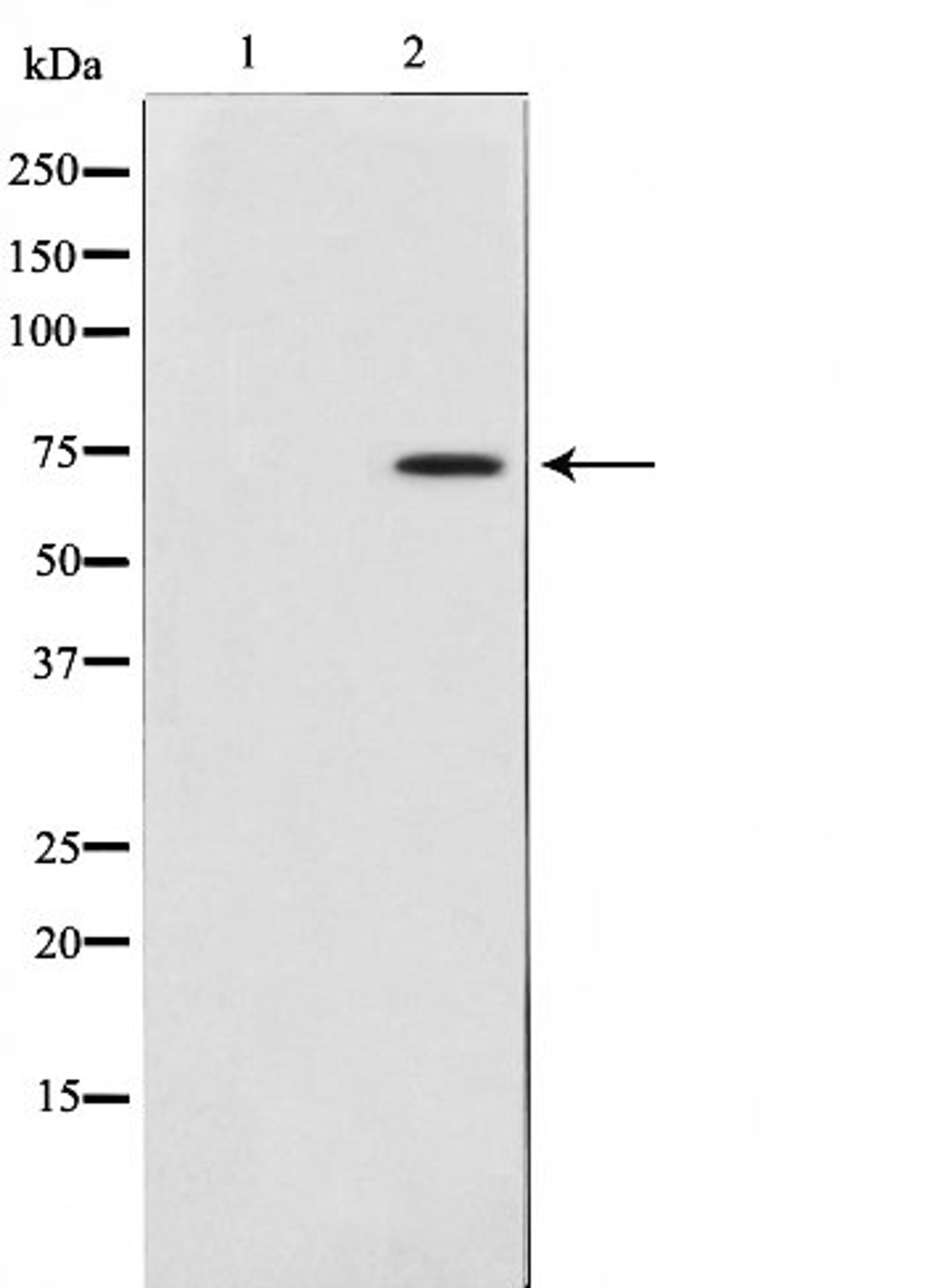 Western blot analysis of 3T3 cell lysate using Collagen XIIIalpha 1 antibody