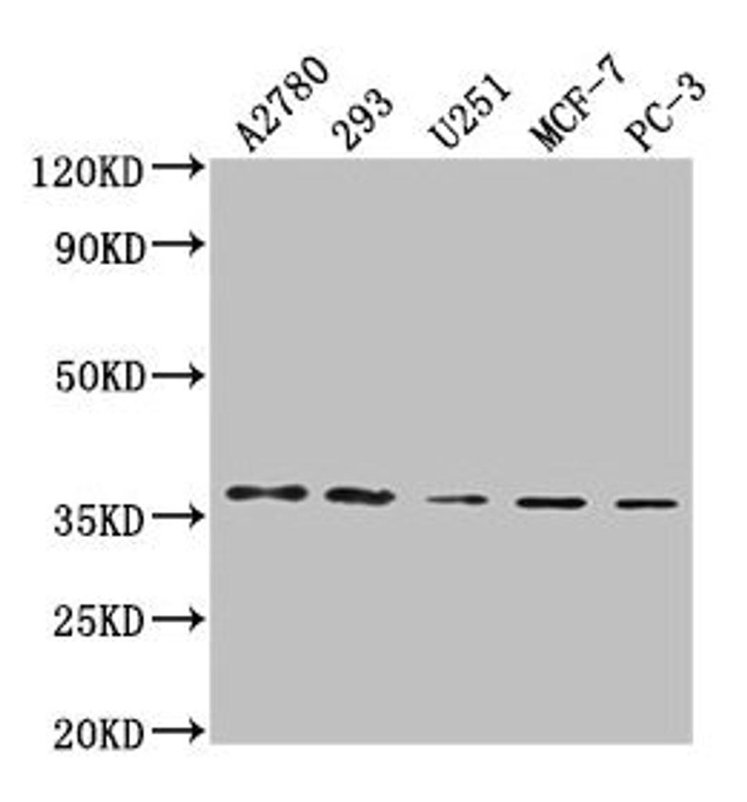 Western Blot. Positive WB detected in: A2780 whole cell lysate, 293 whole cell lysate, U251 whole cell lysate, MCF-7 whole cell lysate, PC-3 whole cell lysate. All lanes: PDCL3 antibody at 1:2000. Secondary. Goat polyclonal to rabbit IgG at 1/50000 dilution. Predicted band size: 28 kDa. Observed band size: 37 kDa