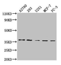 Western Blot. Positive WB detected in: A2780 whole cell lysate, 293 whole cell lysate, U251 whole cell lysate, MCF-7 whole cell lysate, PC-3 whole cell lysate. All lanes: PDCL3 antibody at 1:2000. Secondary. Goat polyclonal to rabbit IgG at 1/50000 dilution. Predicted band size: 28 kDa. Observed band size: 37 kDa