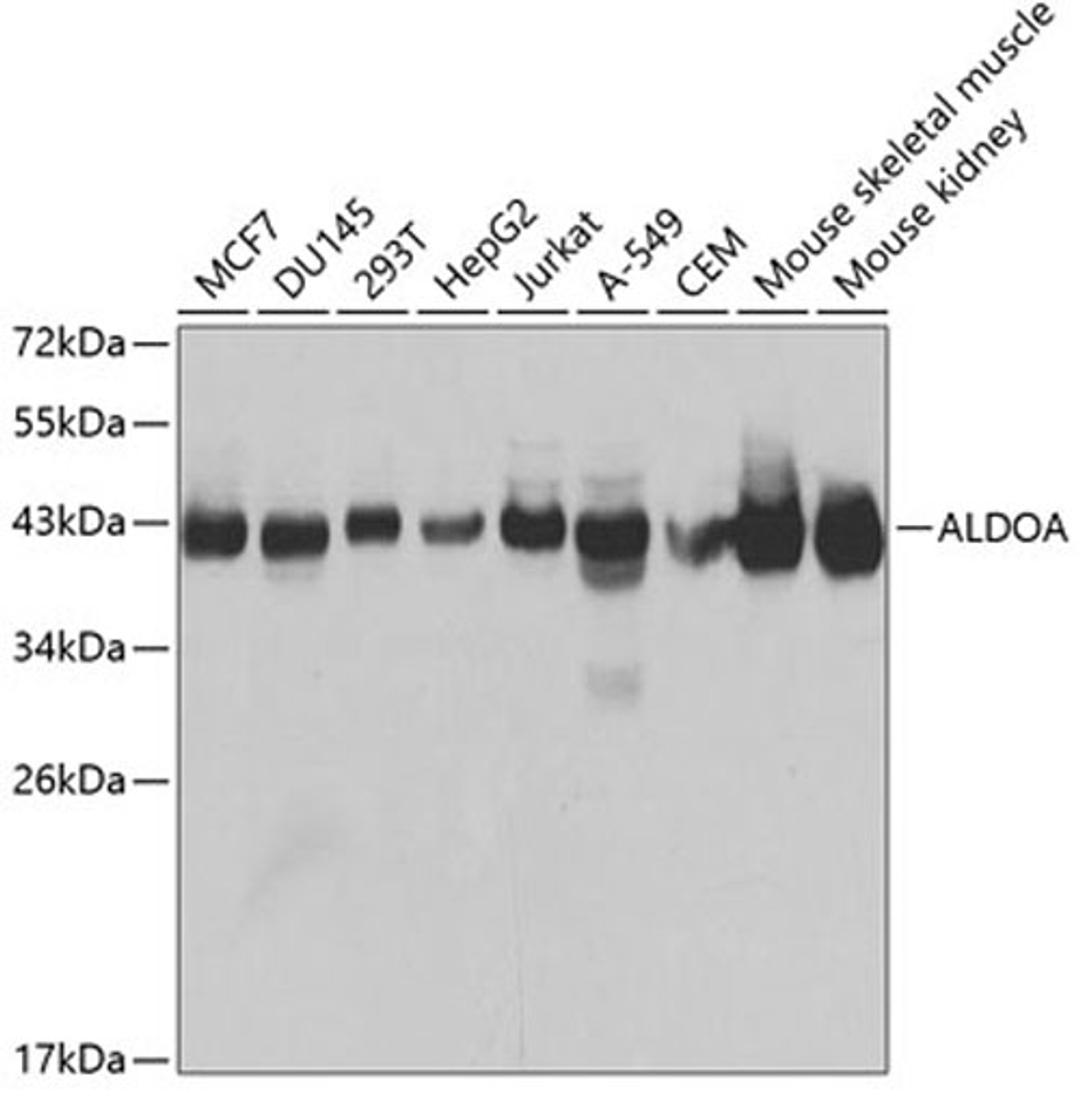 Western blot - ALDOA antibody (A1142)