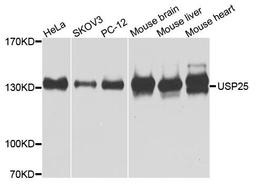 Western blot analysis of extracts of various cells using USP25 antibody