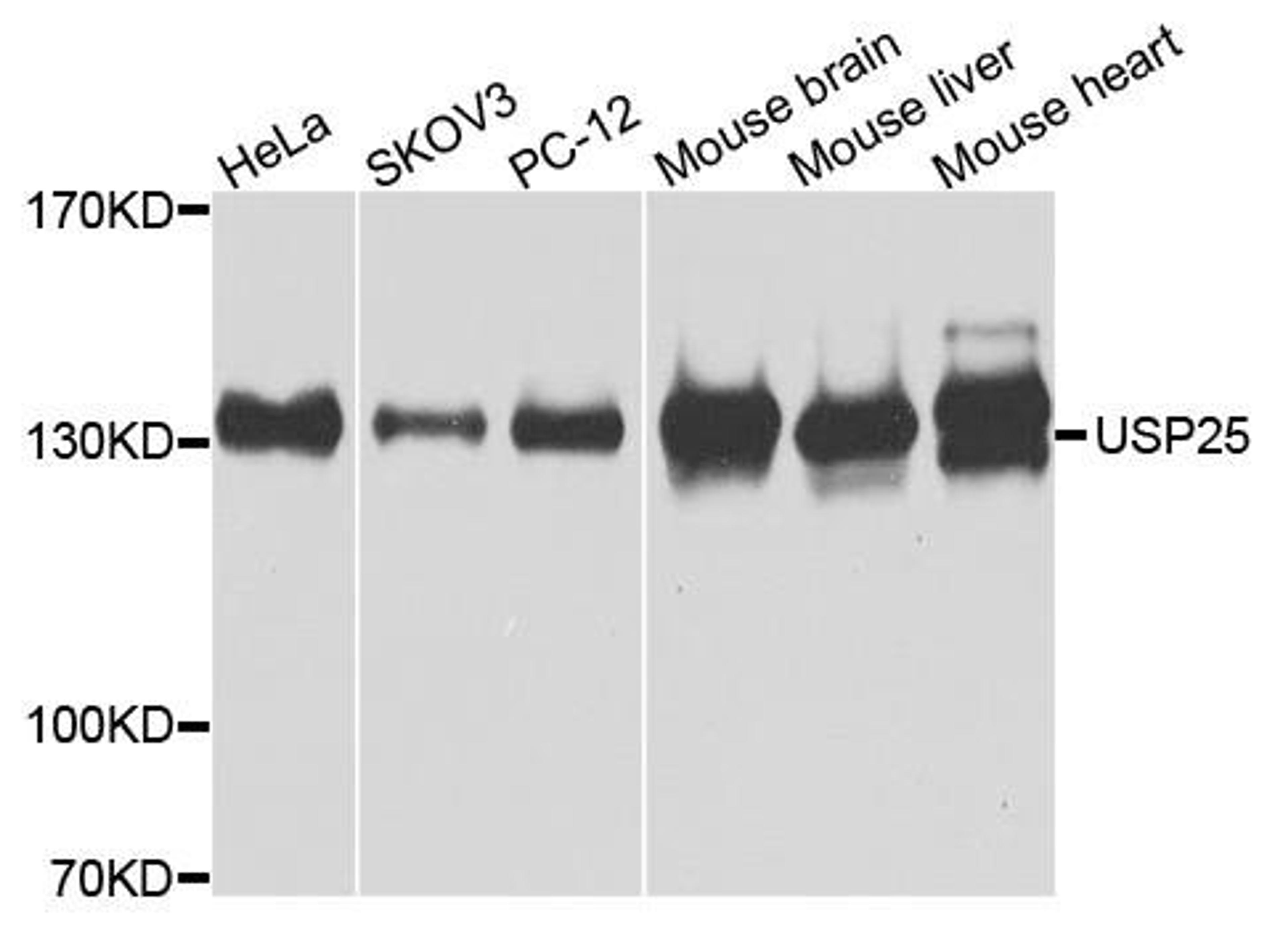 Western blot analysis of extracts of various cells using USP25 antibody