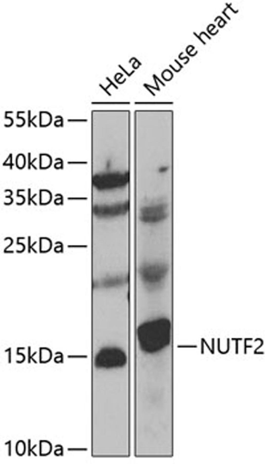 Western blot - NUTF2 antibody (A7057)