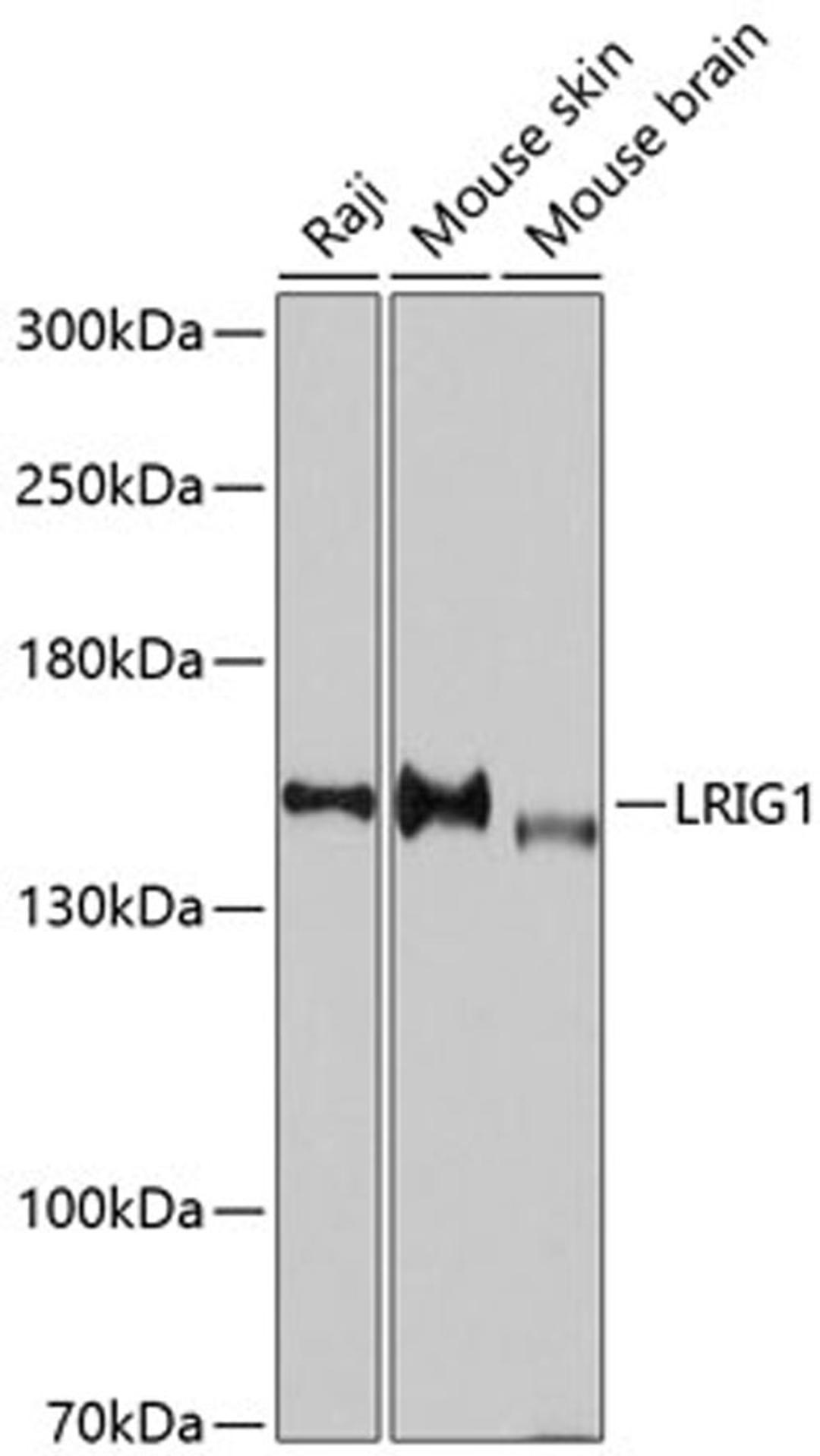 Western blot - LRIG1 antibody (A10297)