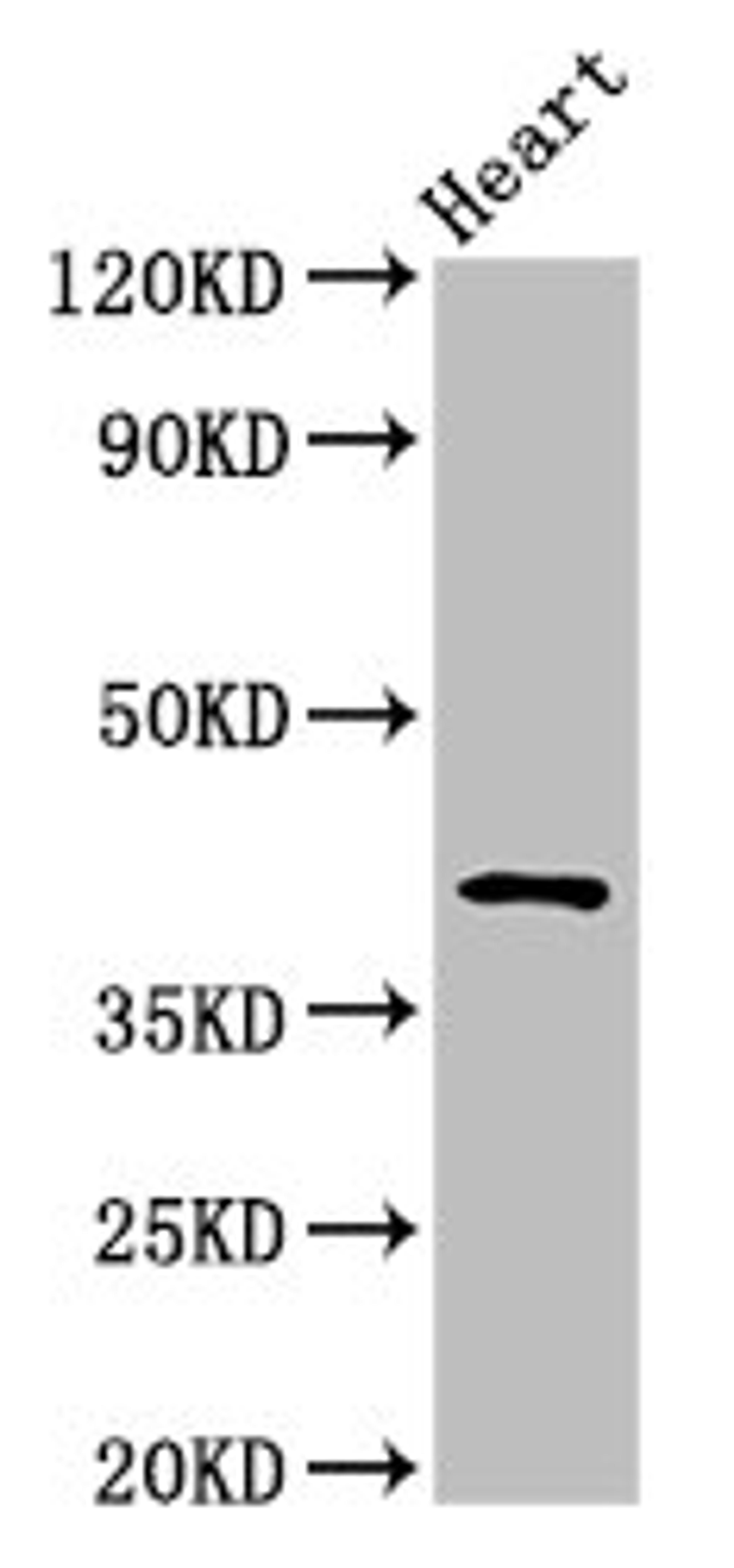 Western Blot. Positive WB detected in: Rat heart tissue. All lanes: JAM3 antibody at 2.5ug/ml. Secondary. Goat polyclonal to rabbit IgG at 1/50000 dilution. Predicted band size: 36, 30 kDa. Observed band size: 45 kDa. 